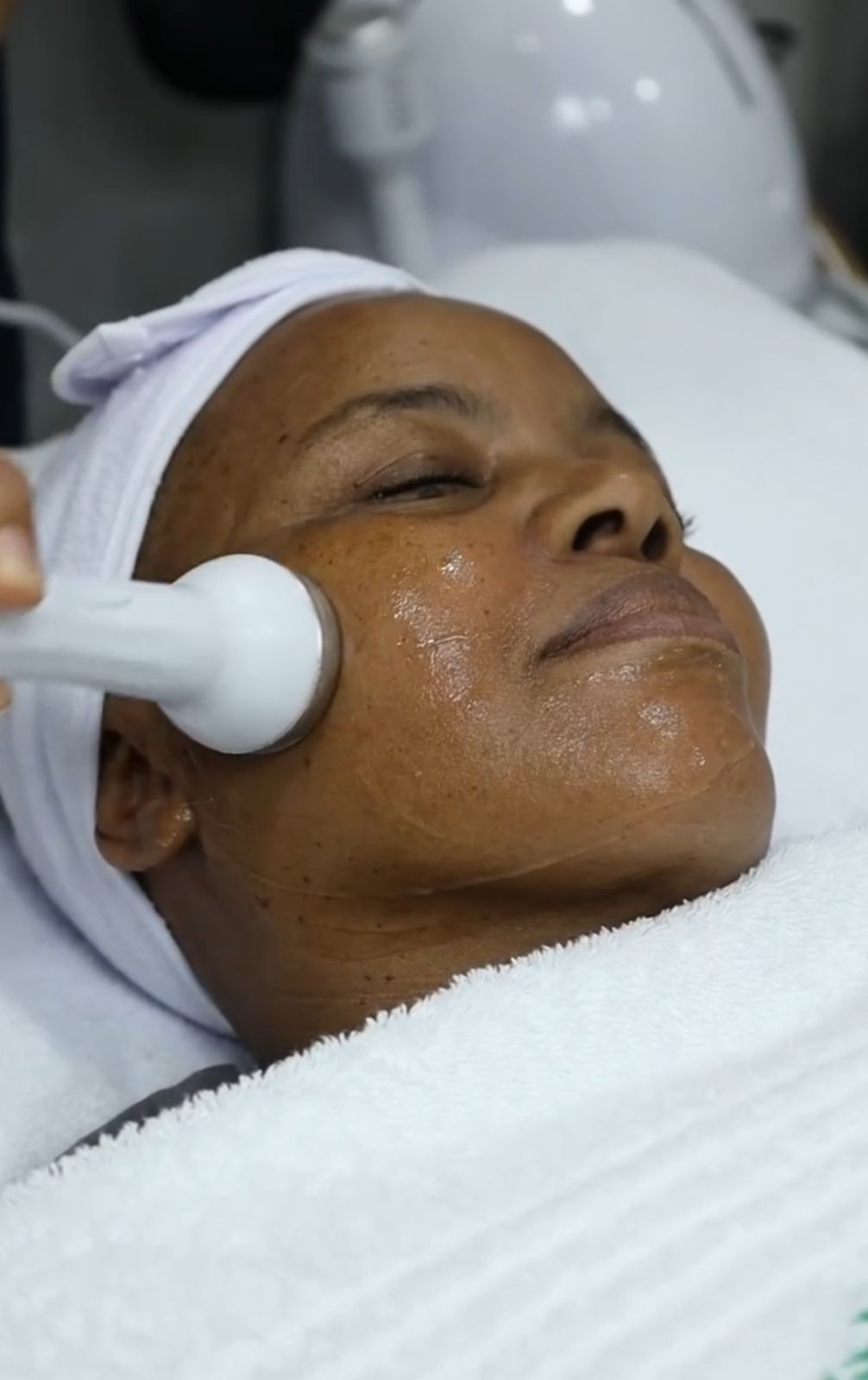 Under Eye Filler